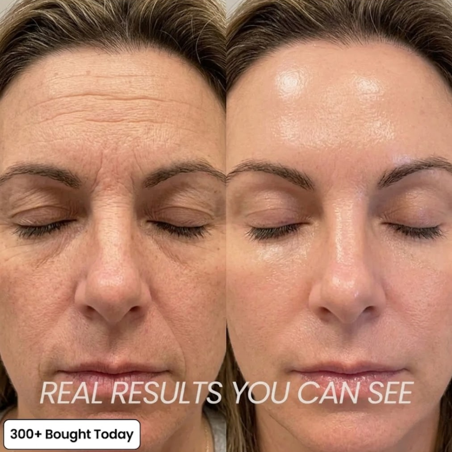 PDRN Tired-Skin Revival Balm